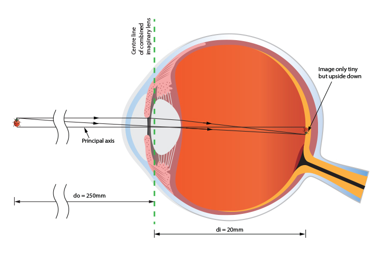 Ladybird focused on the retina of a human eye